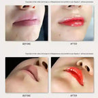 BB Lips Serum Starter Kit 8ml, BABBAK'S LTD